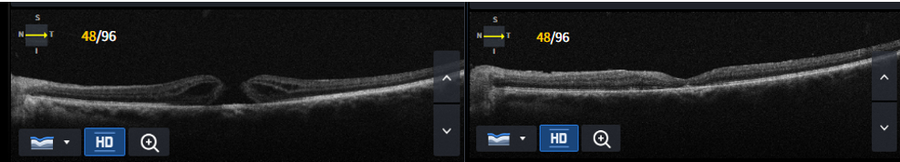Slider image (10) Dr Nikolaos I Dervenis Eye Clinic